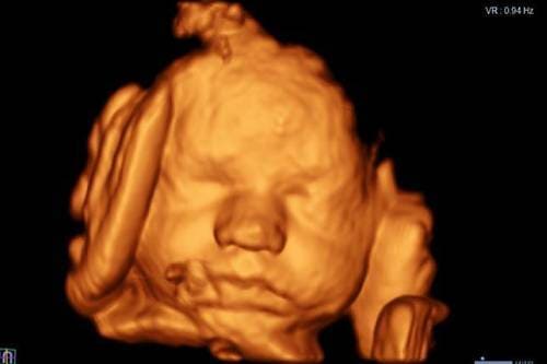 Ultrasonido en 4D o 5D